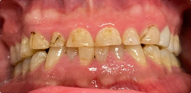 General Dentistry in Scottsdale